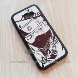 ເຄສທັງໝົດ